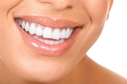 Close-up of a smiling woman showcasing straight, white teeth, representing the benefits of Invisalign clear aligners offered by The Village Dental in Pinecrest, FL, for a confident smile makeover.