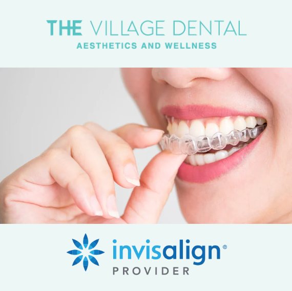 Invisalign provider at The Village Dental in Pinecrest, FL, showcasing a patient applying clear aligners for cosmetic orthodontic treatment.